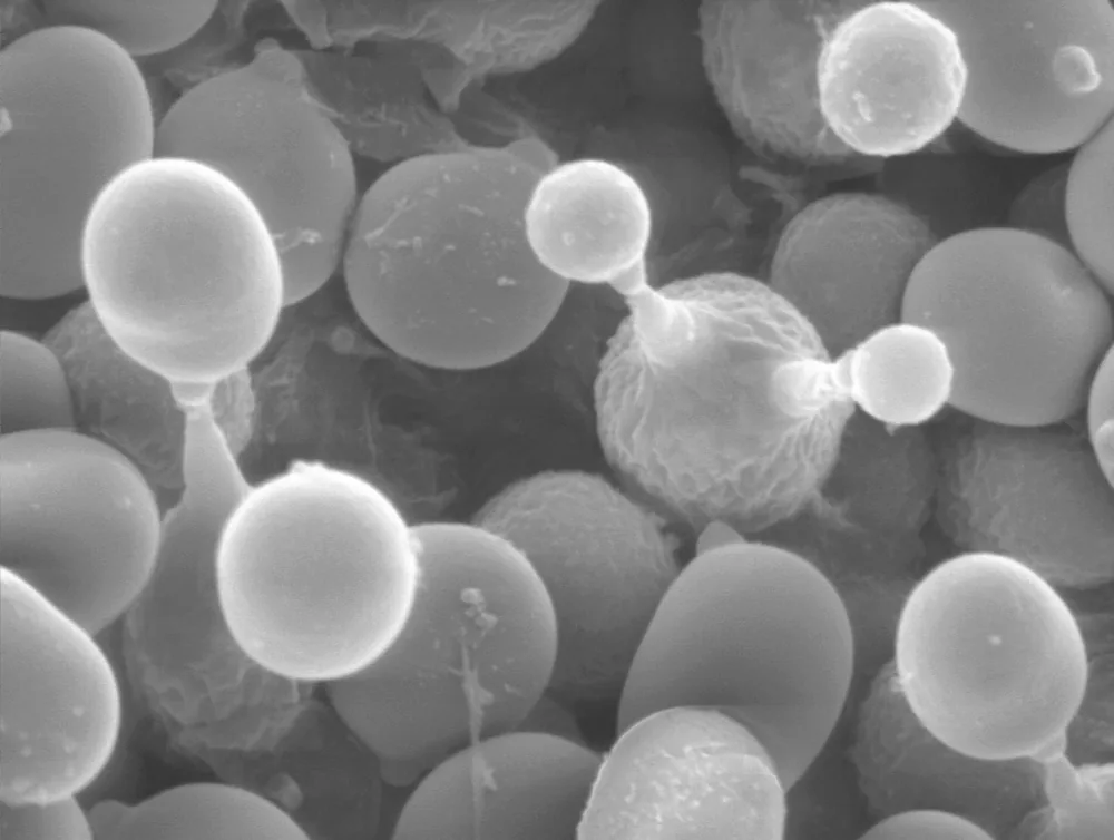 Scanning electron micrograph of budding Agaricus bisporus basidiospores (Dartmouth Electron Microscope Facility, public domain) — representative of the basidiospore category a spore-trap lab reports.