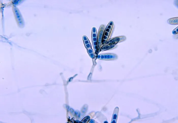 Conidiophore and dark septate spores of Bipolaris (CDC Public Health Image Library, public domain) — a dematiaceous mold reported on indoor spore-trap panels.