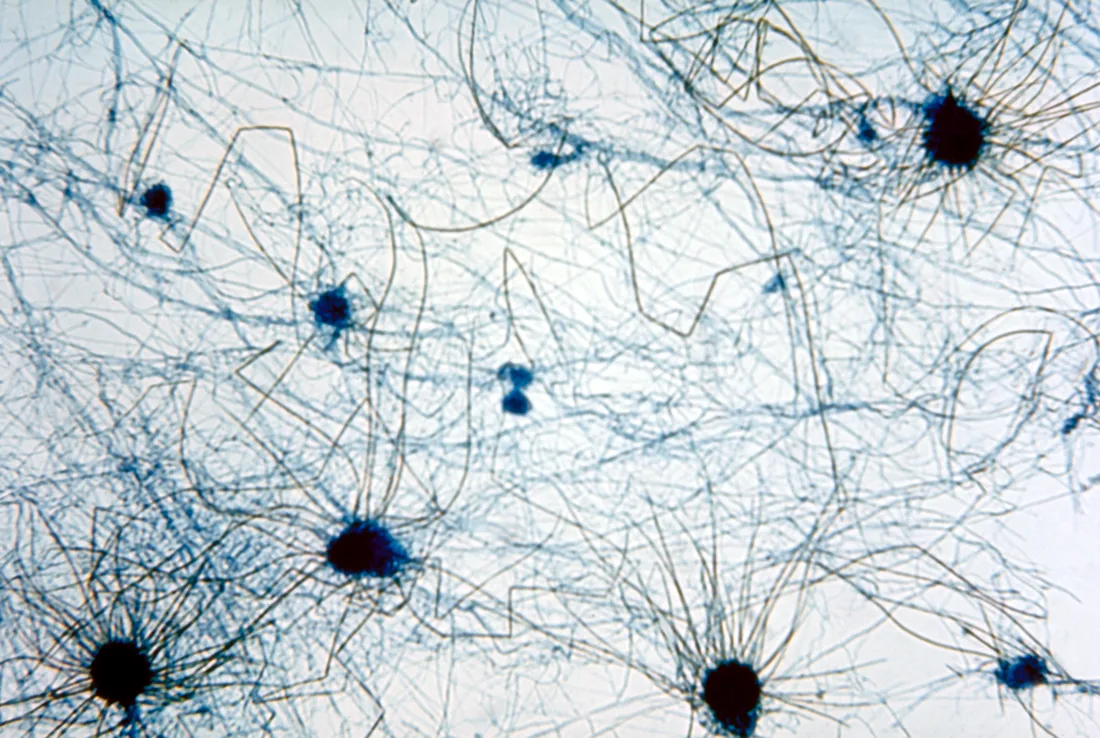Photomicrograph of Chaetomium perithecia (CDC Public Health Image Library, public domain) — the dark, flask-shaped fruiting bodies with radiating filaments that mark this water-damage indicator genus found behind drywall after sustained moisture.