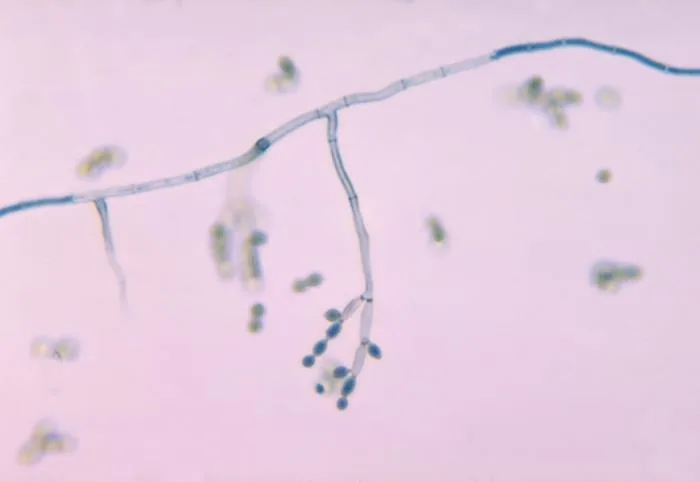 Photomicrograph of Cladosporium (CDC Public Health Image Library, public domain) — the branching chains of conidia budding from a septate conidiophore that identify this genus, commonly isolated from bathrooms and HVAC drip pans.