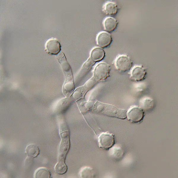 Light micrograph of Scopulariopsis brevicaulis conidiophores and conidia (Wikimedia Commons, CC0 public-domain dedication) — a water-damage indicator mold.